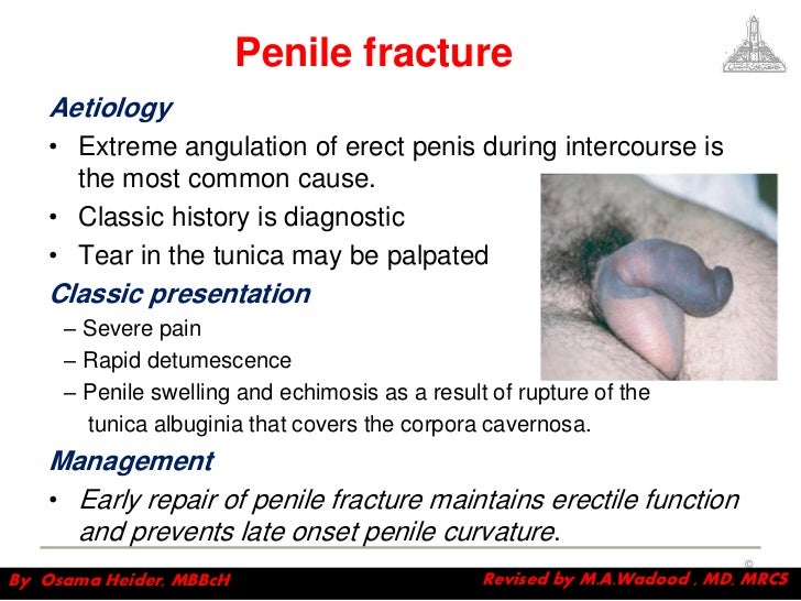 Free Pregnant Porn Tubes Fractured Penis Pictures